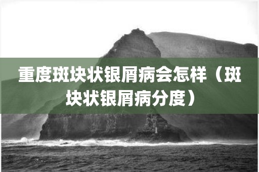 重度斑块状银屑病会怎样（斑块状银屑病分度）