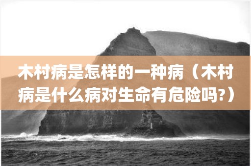 木村病是怎样的一种病（木村病是什么病对生命有危险吗?）