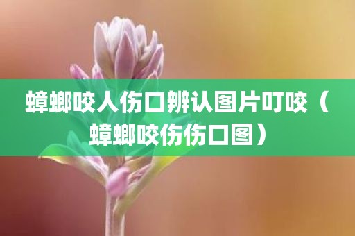 蟑螂咬人伤口辨认图片叮咬(蟑螂咬伤伤口图) 蟑螂咬人伤口辨认图片叮咬(蟑螂咬伤伤口图)