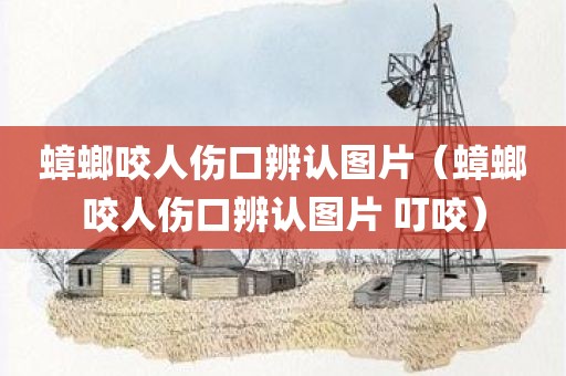 蟑螂咬人伤口辨认图片（蟑螂咬人伤口辨认图片 叮咬）